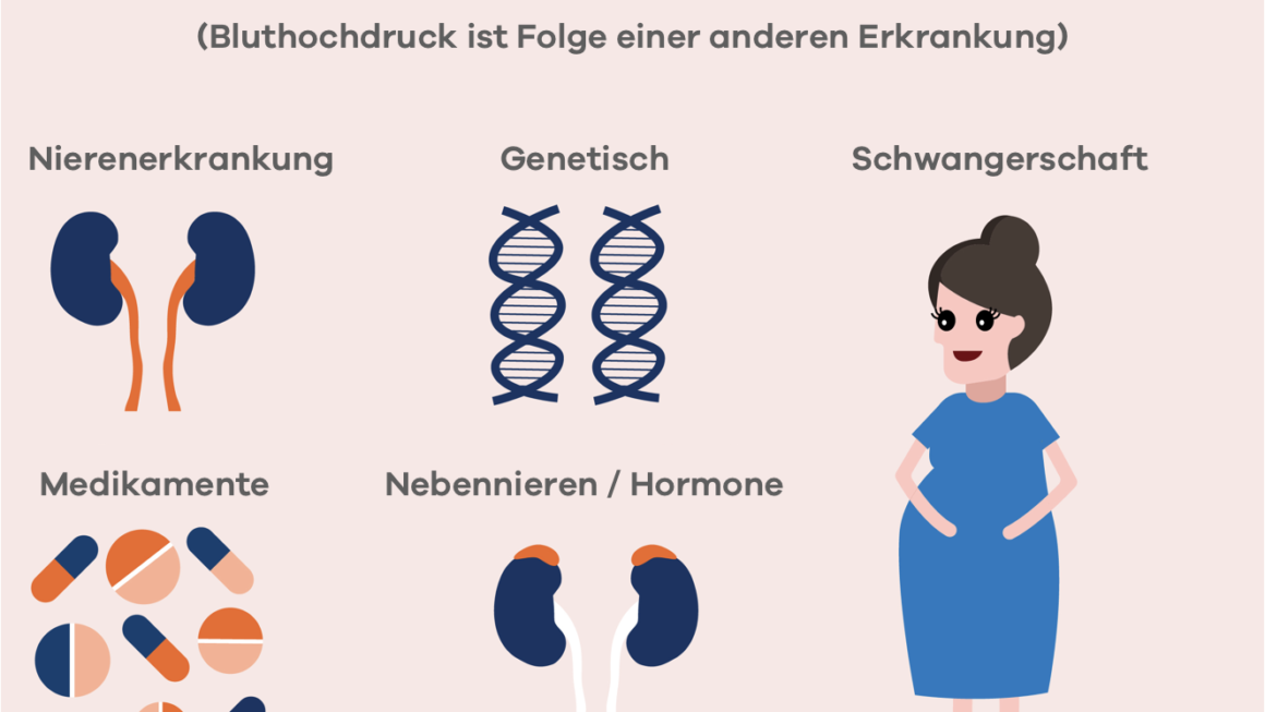 Was ist Hypertonie 2026: Alles über Bluthochdruck verständlich erklärt